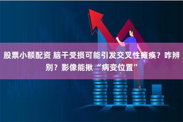 股票小额配资 脑干受损可能引发交叉性瘫痪？咋辨别？影像能揪 “病变位置”